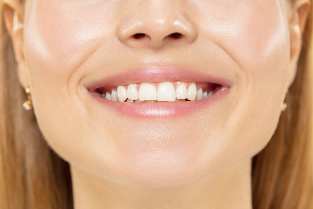 Is Teeth Whitening Harmful?