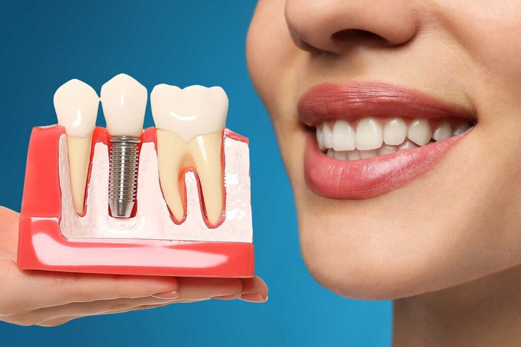 Implant Treatment and Care